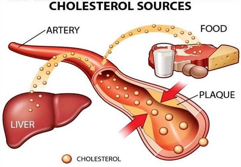 Acipimox là thuốc điều trị tình trạng rối loạn lipid huyết