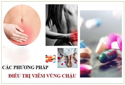 Điều trị viêm vùng chậu