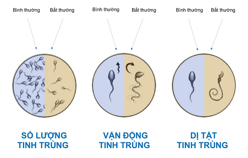 Tinh trùng yếu có dấu hiệu như thế nào?