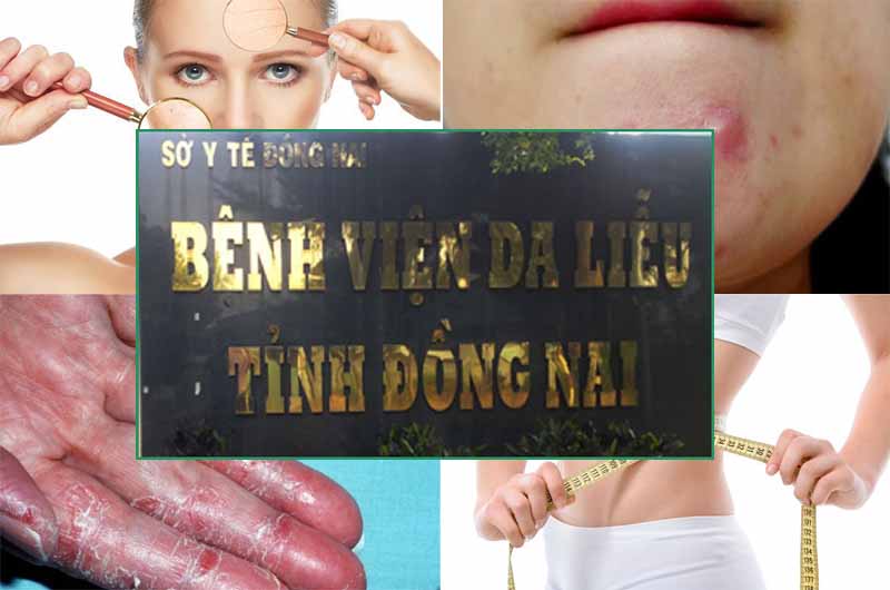 Bệnh viện Da liễu Đồng Nai