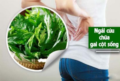 Chữa gai cột sống bằng ngải cứu