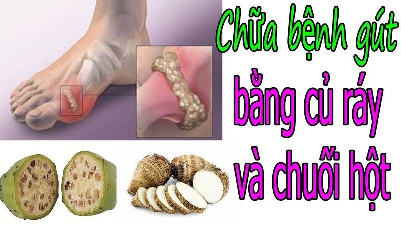 Chữa gout là một trong những tác dụng chữa bệnh của củ ráy