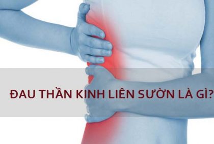 Đau thần kinh liên sườn