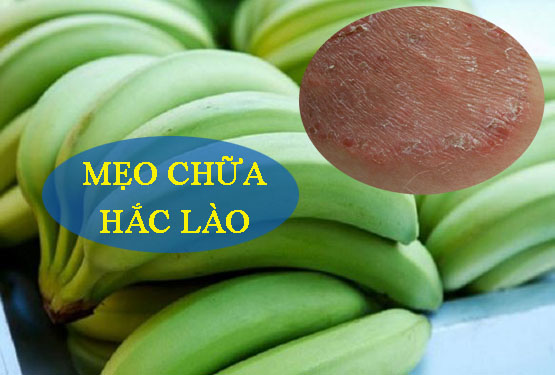 Mẹo chữa hắc lào