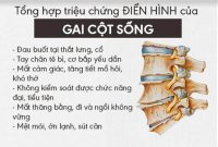 triệu chứng gai cột sống