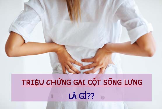 Triệu chứng gai cột sống lưng