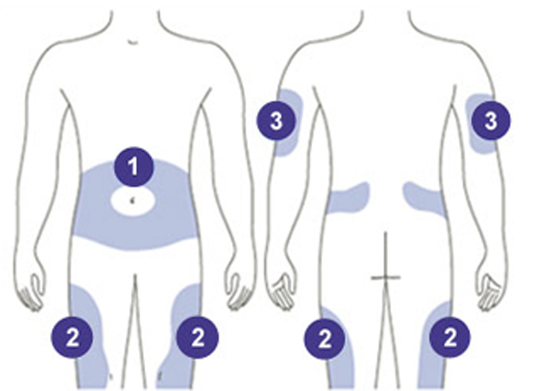 Các khu vực thích hợp để tiêm Lantus