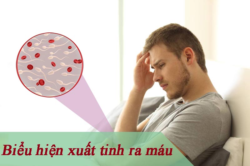 Biểu hiện xuất tinh ra máu ở nam giới là gì?