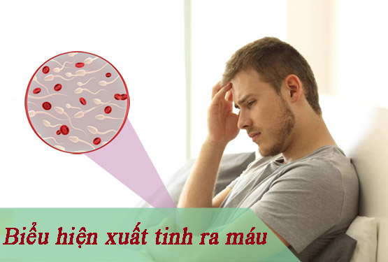 Biểu hiện xuất tinh ra máu