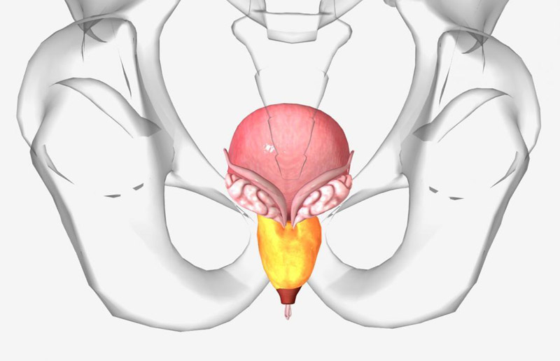 Viêm tuyến tiền liệt hoặc các bệnh viêm nhiễm khác là nguyên nhân hàng đầu gây xuất tinh ra máu kéo dài