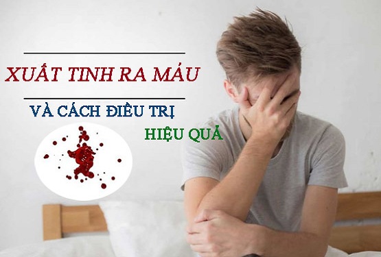 Xuất tinh ra máu và cách điều trị