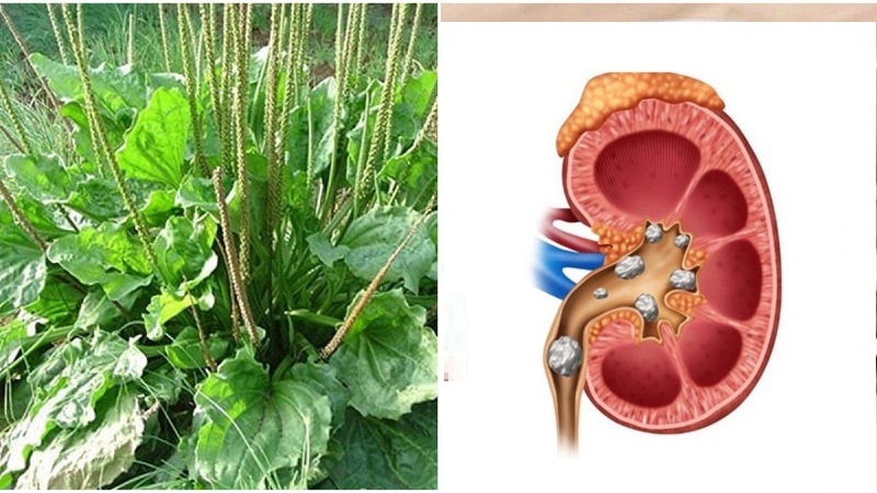 Cây mã đề giúp cải thiện tình trạng sỏi thận, giảm triệu chứng tiểu rắt, tiểu buốt