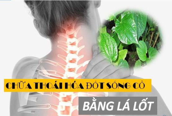 Chữa thoái hóa đốt sống cổ bằng lá lốt