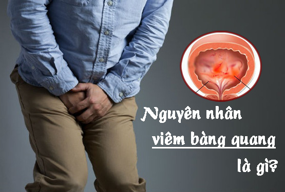 Nguyên nhân viêm bàng quang