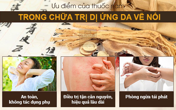 Ưu điểm bài thuốc Mề đay Đỗ Minh chữa dị ứng da vẽ nổi