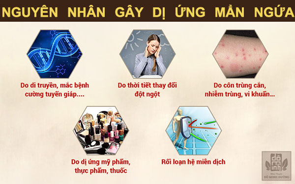 Nguyên nhân gây dị ứng mẩn ngứa