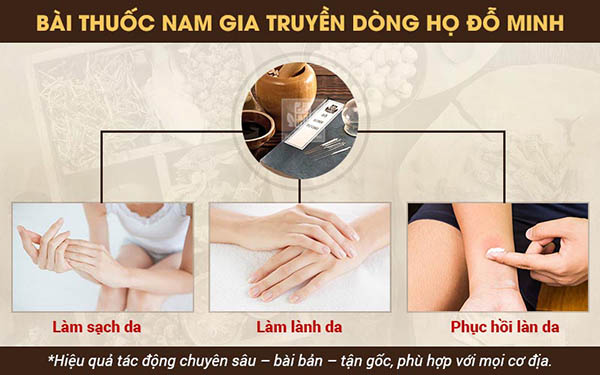 bài thuốc nam gia truyền dòng họ Đỗ Minh