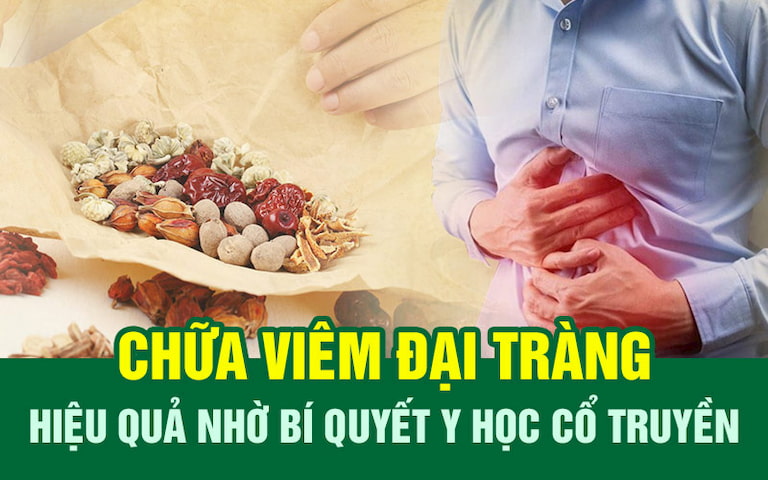 Chữa viêm đại tràng tại Trung tâm Thuốc dân tộc