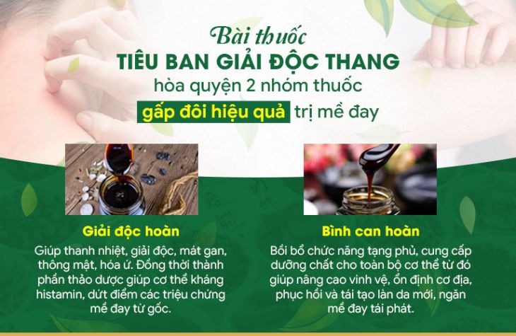 Tiêu ban Giải độc thang mang công thức đặc biệt điều trị dứt điểm mề đay 