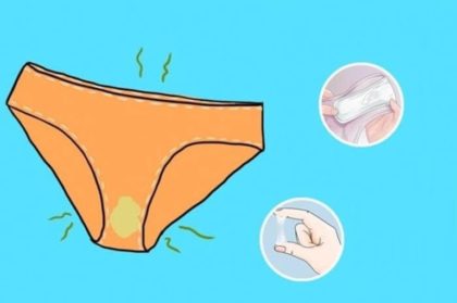 Khí hư có mùi hôi khiến nhiều chị em ám ảnh