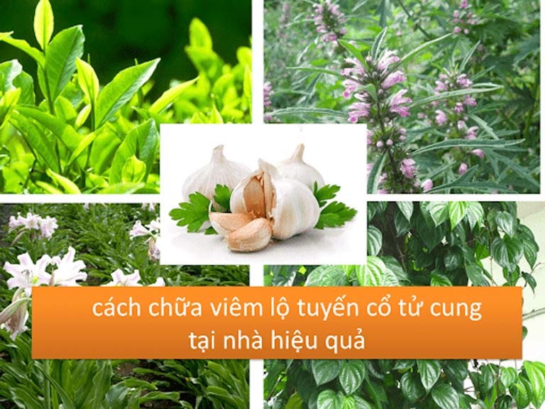 Mẹo dân gian chữa viêm lộ tuyến cho chị em