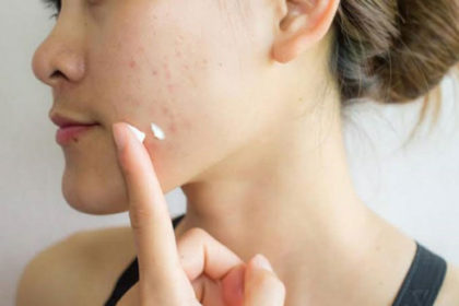 Kem thuốc trị mụn thâm