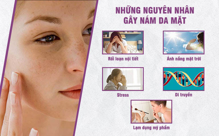 Có nhiều nguyên nhân gây ra nám sạm