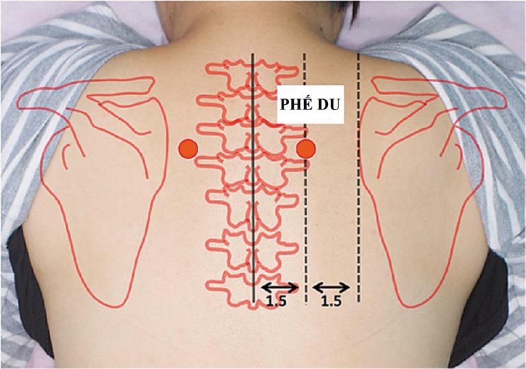 cách bấm huyệt chữa đau vai gáy