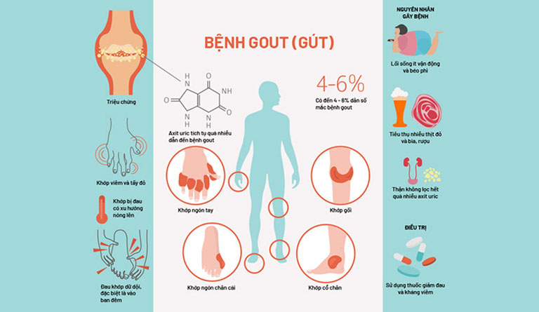 bệnh gout là gì