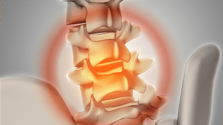 điều trị đau dây thần kinh hông to