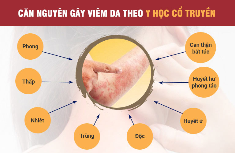 Những nguyên nhân chủ yếu gây bệnh da liễu theo Đông y