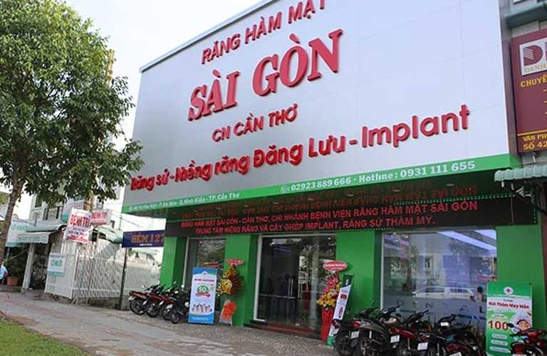 niềng răng trả góp Cần Thơ