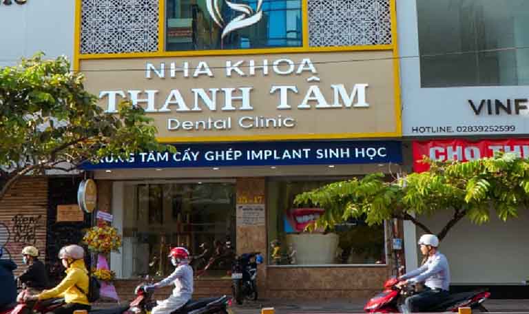 nha khoa Thanh Tâm lấy cao răng uy tín ở tphcm