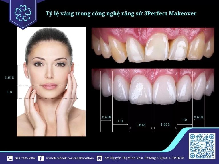 Nha khoa Flora ứng dụng công nghệ răng sứ 3Perfect Makeover để bọc răng sứ cho khách hàng