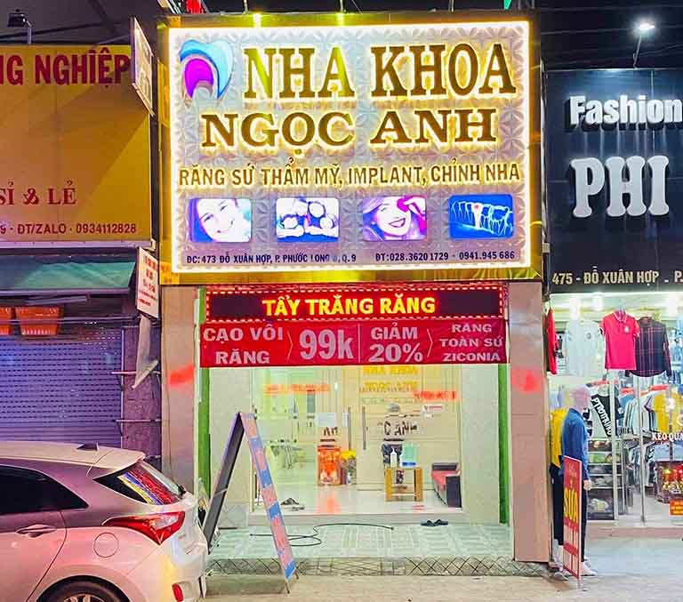 nha khoa niềng răng quận 9 Ngọc Anh