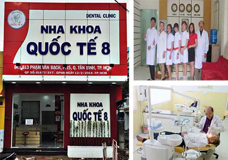 Nha Khoa Cạo Vôi Răng Tân Bình Giá Rẻ