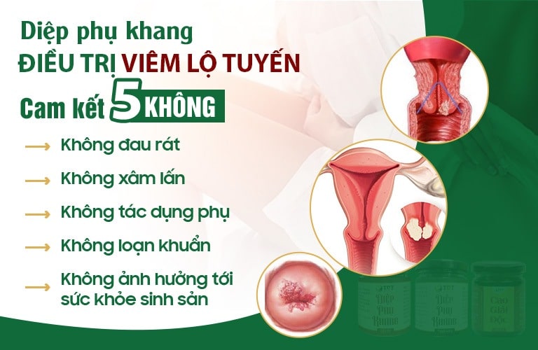 Cam kết 5 KHÔNG của Diệp Phụ Khang